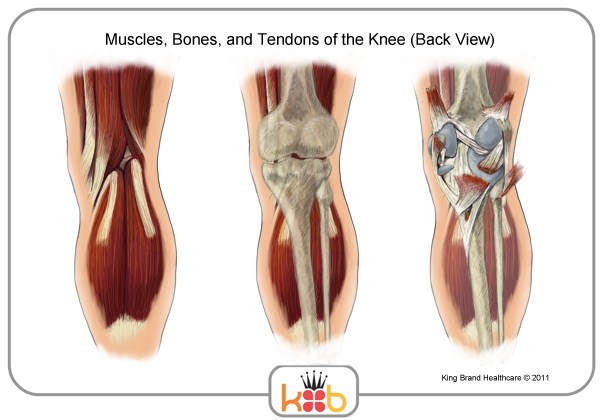 King Brand Back View of the Knee Diagram Labels King Brand Knee Injury Muscles Bones Tendons