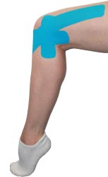 Kingbrand Blue Taping for the Lateral Knee