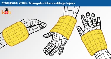 A wire drawing showing the coverage zone that a King Brand® Wrist Wrap would have to be able to treat a Triangular Fibrocartilage injury