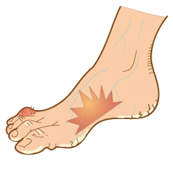 Aging Feet Foot Tendonitis