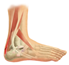 X-Ray View of the Ligaments of the Ankle