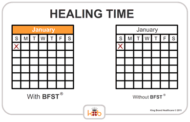 Calendar With and Without BFST