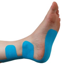Insertional Achilles Tendonitis Taping Guideline