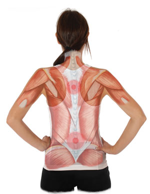 X-Ray View of Pain Locations in the Back