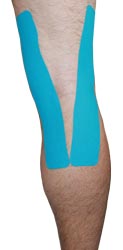 Kingbrand Blue Taping for the Back of the Knee