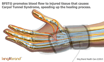 An Animation of a King Brand® BFST® Wrist Wrap actively promoting blood flow to heal a Carpal Tunnel injury