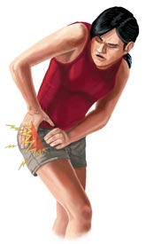 An Illustration of a Woman With Hip Bursitis