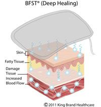 King Brand Knee Wrap BFST Works Beneath the Skin Blood Flow Stimulation Heal Damaged Tissue Best Therapy on Market