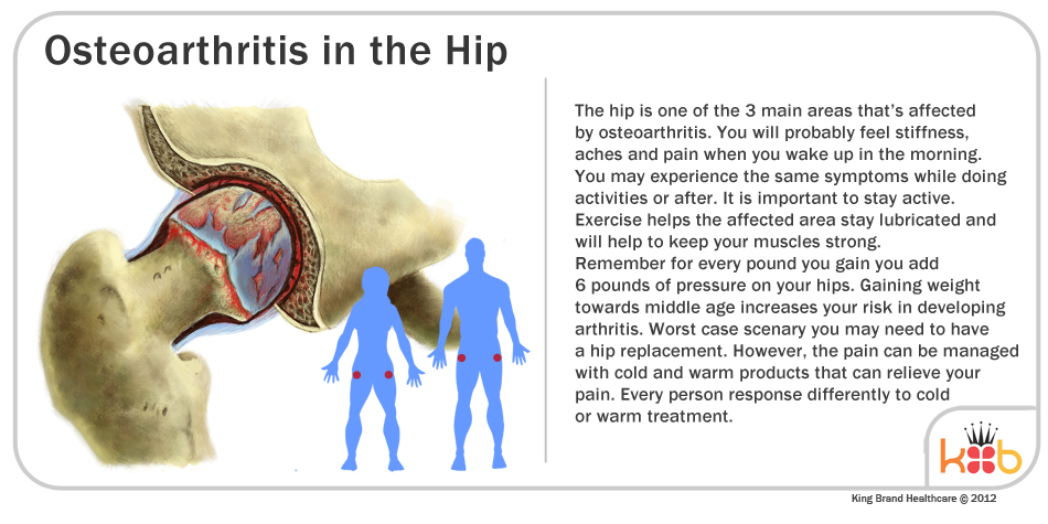 Informational Diagram of Osteoarthritis in the Hip