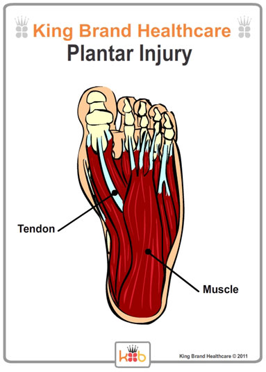 King Brand Foot Plantar Injury Muscle Tendons Diagram Illustration