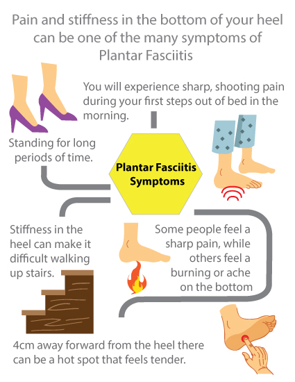 King Brand Plantar Fasciitis Infographic Important Facts and Information