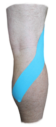 Popliteus Muscle 2 Inch Taping