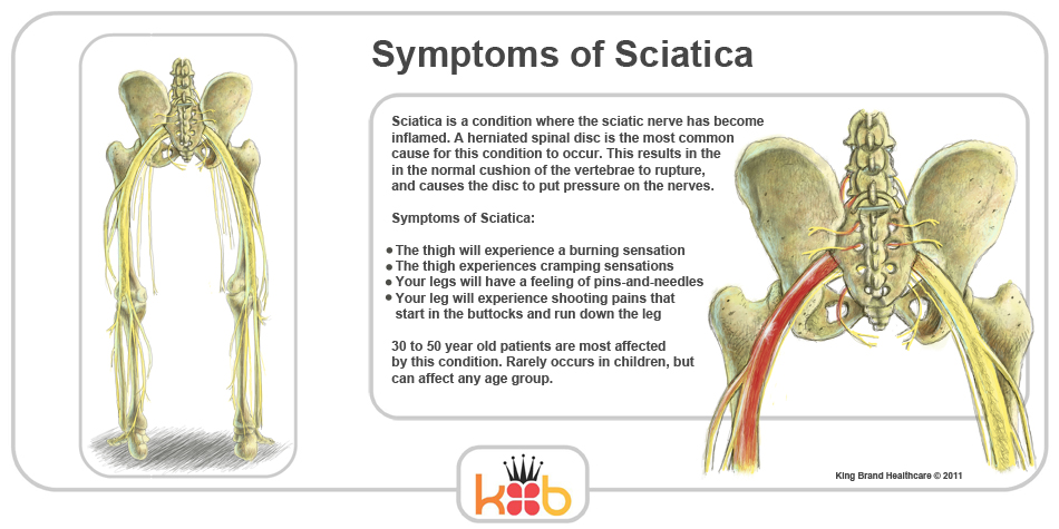 King Brand Sciatica Symptoms and Explation with Diagram