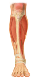 An Internal Drawing of a Leg with Shin Splints