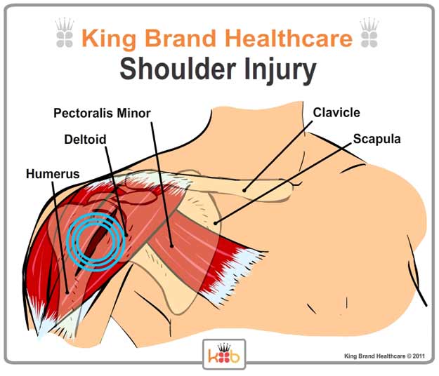 King Brand Labelled Diagram of Shoulder Injury and Treatment Area Front View Muscles and Bones