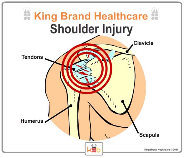 King Brand Labelled Diagram of Shoulder Injury and Treatment Area Front View Zoom Close Up Bones