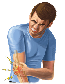An Illustration of a Man in Pain Due to their Tennis Elbow Injury