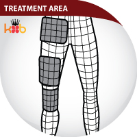 BFST IT Band Treatment Areas