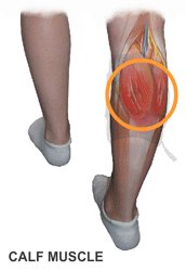 An Internal Animation of the King Brand BFST Wrap Treating a Torn Calf Muscle
