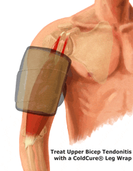 An Animation of King Brand's Leg ColdCure Wrap in Action on an Upper Tendonitis Injury