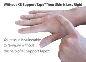 An animation demonstrating how loose the skin is without KB Support Tape, leaving it more prone to re-injury