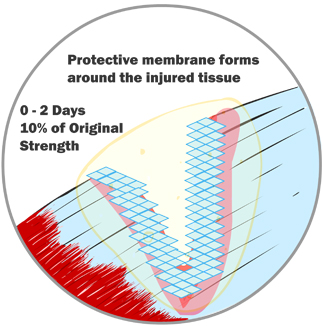 Protective Membrane