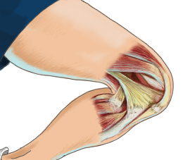 Knee Bursitis Information
